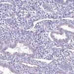 RAB11FIP5 Antibody in Immunohistochemistry (IHC)