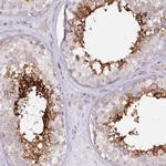 RAB11FIP5 Antibody in Immunohistochemistry (IHC)