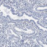 RAB11FIP5 Antibody in Immunohistochemistry (IHC)