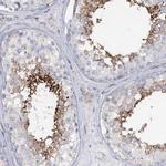 RAB11FIP5 Antibody in Immunohistochemistry (IHC)