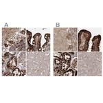 LRP130 Antibody in Immunohistochemistry (IHC)