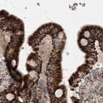 LRP130 Antibody in Immunohistochemistry (IHC)