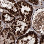 LRP130 Antibody in Immunohistochemistry (IHC)