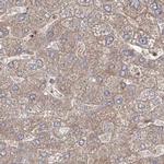 LRP130 Antibody in Immunohistochemistry (IHC)