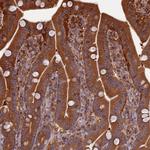 WDR1 Antibody in Immunohistochemistry (Paraffin) (IHC (P))