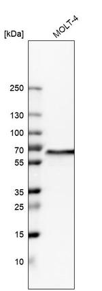 WDR1 Antibody in Western Blot (WB)