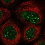 SAB Antibody in Immunocytochemistry (ICC/IF)