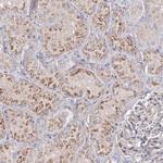 SAB Antibody in Immunohistochemistry (Paraffin) (IHC (P))