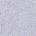 SAB Antibody in Immunohistochemistry (Paraffin) (IHC (P))