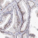 SAB Antibody in Immunohistochemistry (Paraffin) (IHC (P))