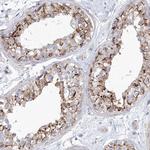 SAB Antibody in Immunohistochemistry (Paraffin) (IHC (P))