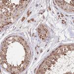 STT3B Antibody in Immunohistochemistry (Paraffin) (IHC (P))