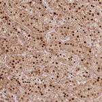 PYURF Antibody in Immunohistochemistry (Paraffin) (IHC (P))