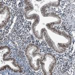 YTHDC1 Antibody in Immunohistochemistry (IHC)