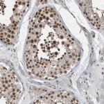 YTHDC1 Antibody in Immunohistochemistry (IHC)