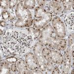 YTHDC1 Antibody in Immunohistochemistry (IHC)