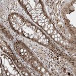 POLR3B Antibody in Immunohistochemistry (Paraffin) (IHC (P))