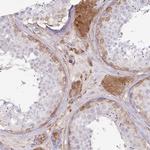 SH3PXD2B Antibody in Immunohistochemistry (Paraffin) (IHC (P))