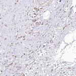 SH3PXD2B Antibody in Immunohistochemistry (IHC)