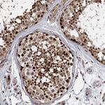 DCUN1D4 Antibody in Immunohistochemistry (Paraffin) (IHC (P))