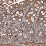 DHRS9 Antibody in Immunohistochemistry (Paraffin) (IHC (P))