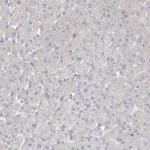 ARHGEF38 Antibody in Immunohistochemistry (Paraffin) (IHC (P))