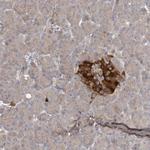 ARHGEF38 Antibody in Immunohistochemistry (Paraffin) (IHC (P))