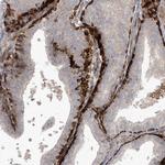 ARHGEF38 Antibody in Immunohistochemistry (Paraffin) (IHC (P))