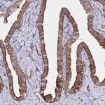 ZIP10 Antibody in Immunohistochemistry (Paraffin) (IHC (P))