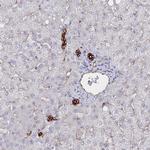 ZIP10 Antibody in Immunohistochemistry (Paraffin) (IHC (P))