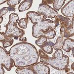 ZIP10 Antibody in Immunohistochemistry (Paraffin) (IHC (P))