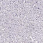 ZIP10 Antibody in Immunohistochemistry (Paraffin) (IHC (P))