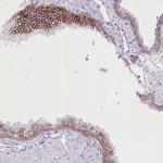 ZIP10 Antibody in Immunohistochemistry (Paraffin) (IHC (P))