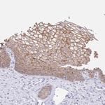 ZIP10 Antibody in Immunohistochemistry (Paraffin) (IHC (P))