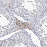 ZNF622 Antibody in Immunohistochemistry (IHC)