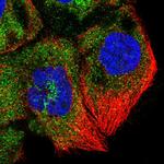 ZNF622 Antibody in Immunocytochemistry (ICC/IF)