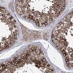 ZNF622 Antibody in Immunohistochemistry (IHC)