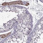 GL54D Antibody in Immunohistochemistry (IHC)