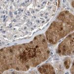 SCFD2 Antibody in Immunohistochemistry (IHC)