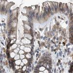 SCFD2 Antibody in Immunohistochemistry (IHC)