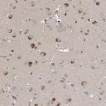 SCFD2 Antibody in Immunohistochemistry (IHC)