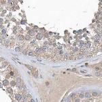 SCFD2 Antibody in Immunohistochemistry (IHC)