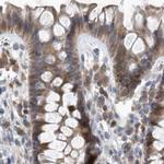 SCFD2 Antibody in Immunohistochemistry (IHC)