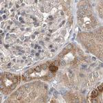 SCFD2 Antibody in Immunohistochemistry (IHC)