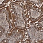 SCLT1 Antibody in Immunohistochemistry (Paraffin) (IHC (P))