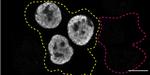 MATR3 Antibody in Immunocytochemistry (ICC/IF)