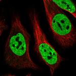 MATR3 Antibody in Immunocytochemistry (ICC/IF)