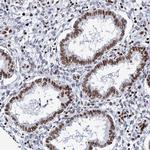 MATR3 Antibody in Immunohistochemistry (IHC)