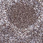 MATR3 Antibody in Immunohistochemistry (IHC)