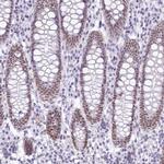 HNRNPA0 Antibody in Immunohistochemistry (Paraffin) (IHC (P))